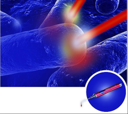 Laser